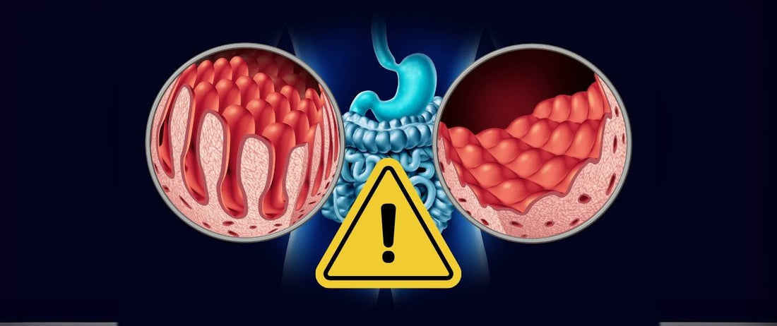 Critical Health Warning for People with Celiac Disease
