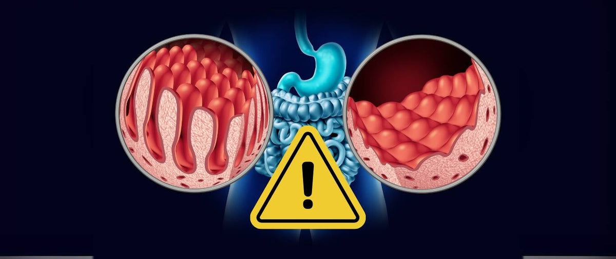Critical Health Warning for People with Celiac Disease