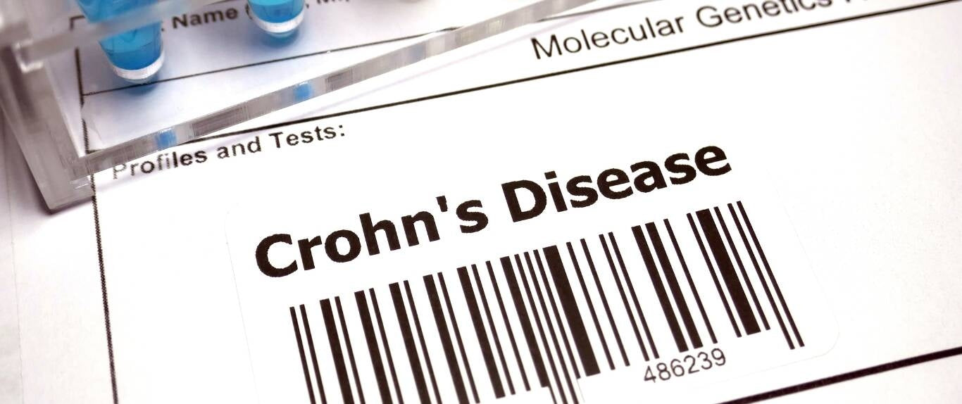 Managing Crohn’s Disease Naturally